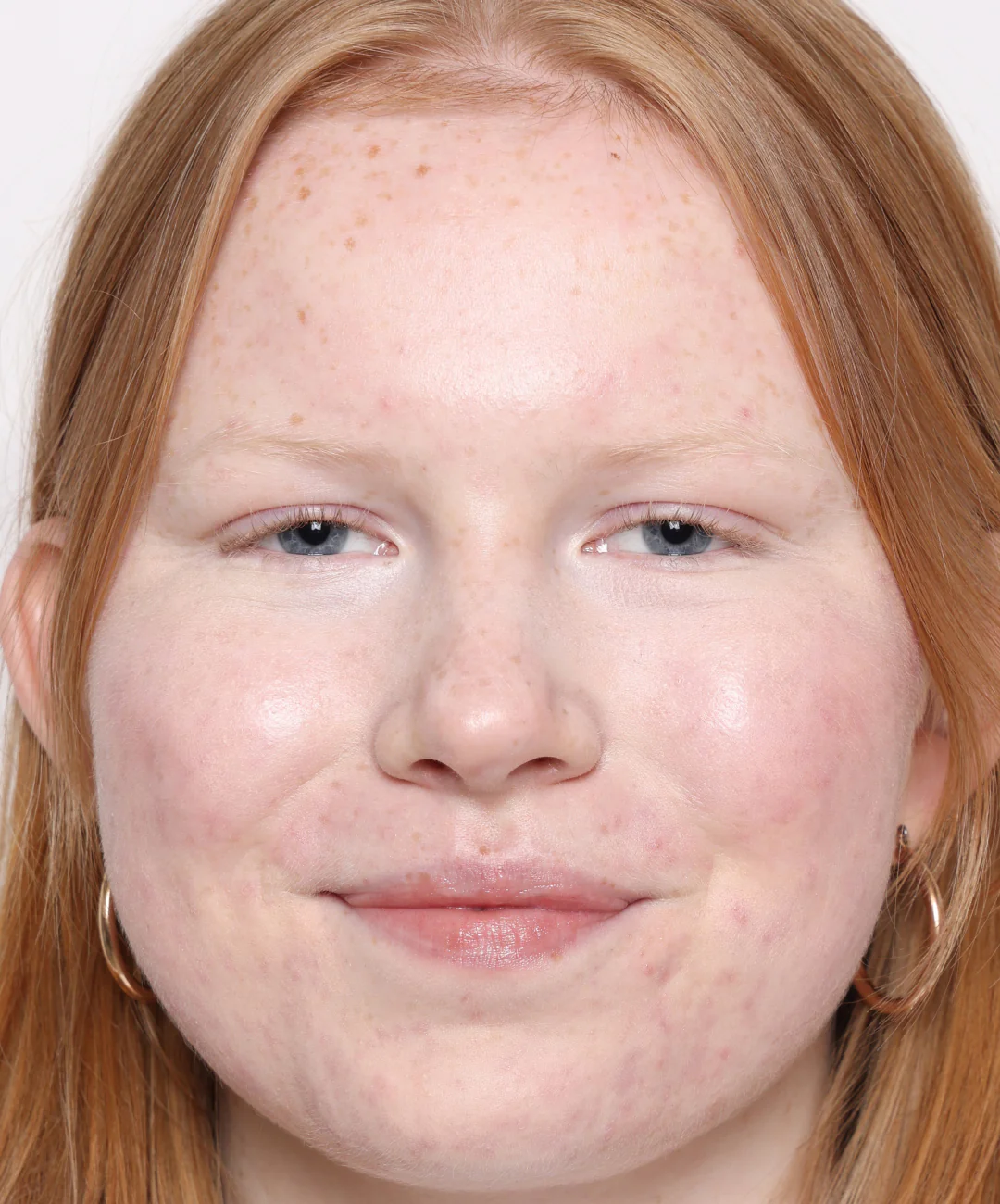 Concealer - Image 5