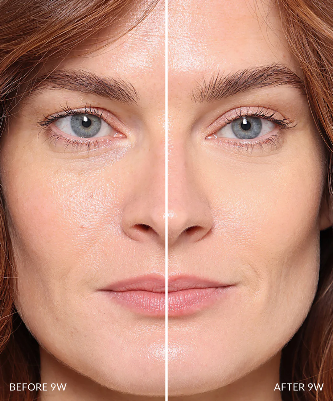 Concealer - Image 67