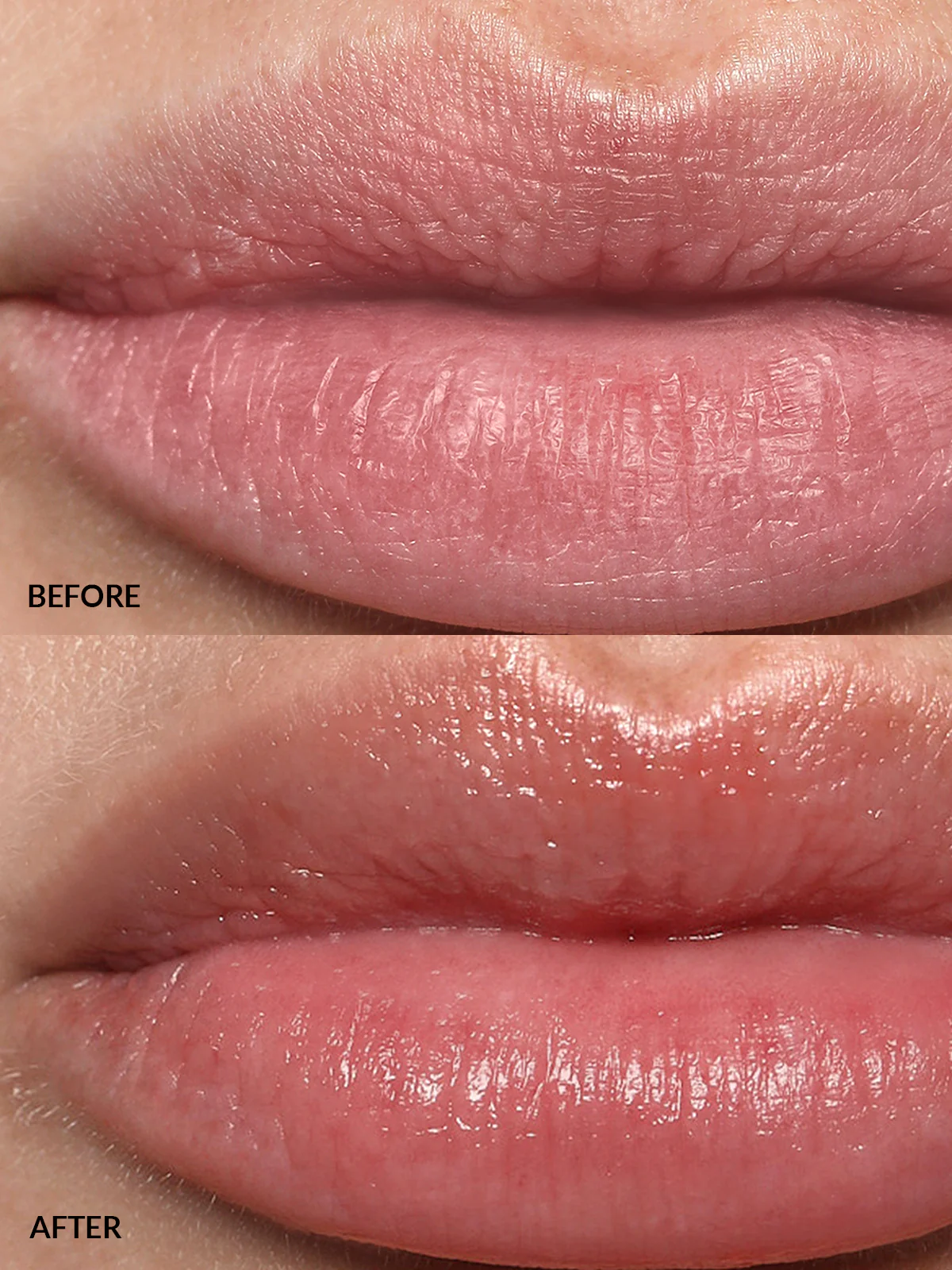 Lip Buff - Image 3