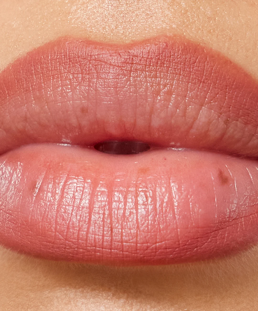Lip Sculpt - Image 23