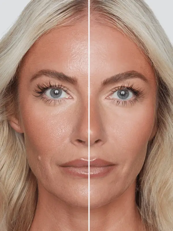 Skin Finish - Image 9